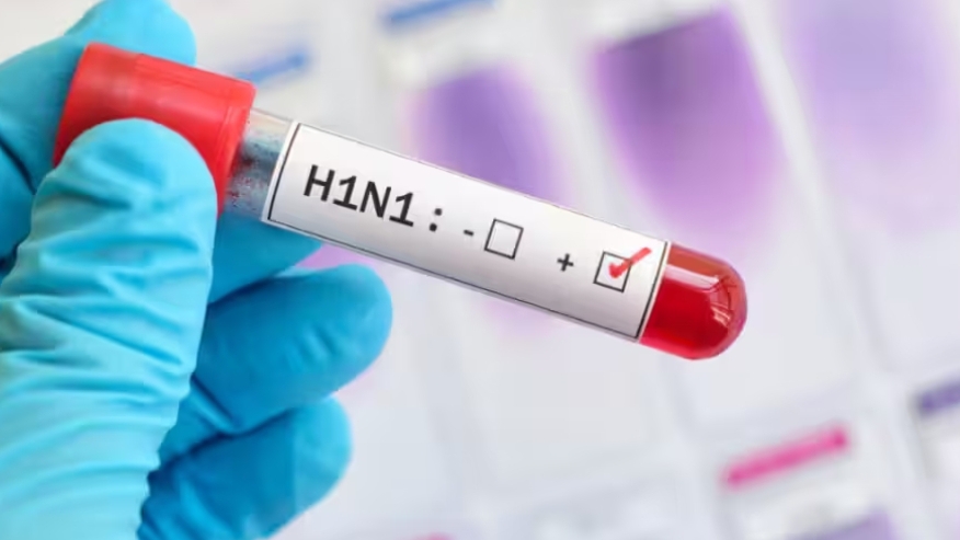 दिल्ली में बढ़ रहे स्वाइन फ्लू के मामले, AIIMS डॉक्टर ने बताया क्यों फैल रहा H1N1; इन लोगों को ज्यादा खतरा